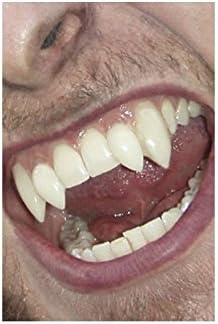 Smiffys Werewolf Fangs - Teens & Adults (27761) 3