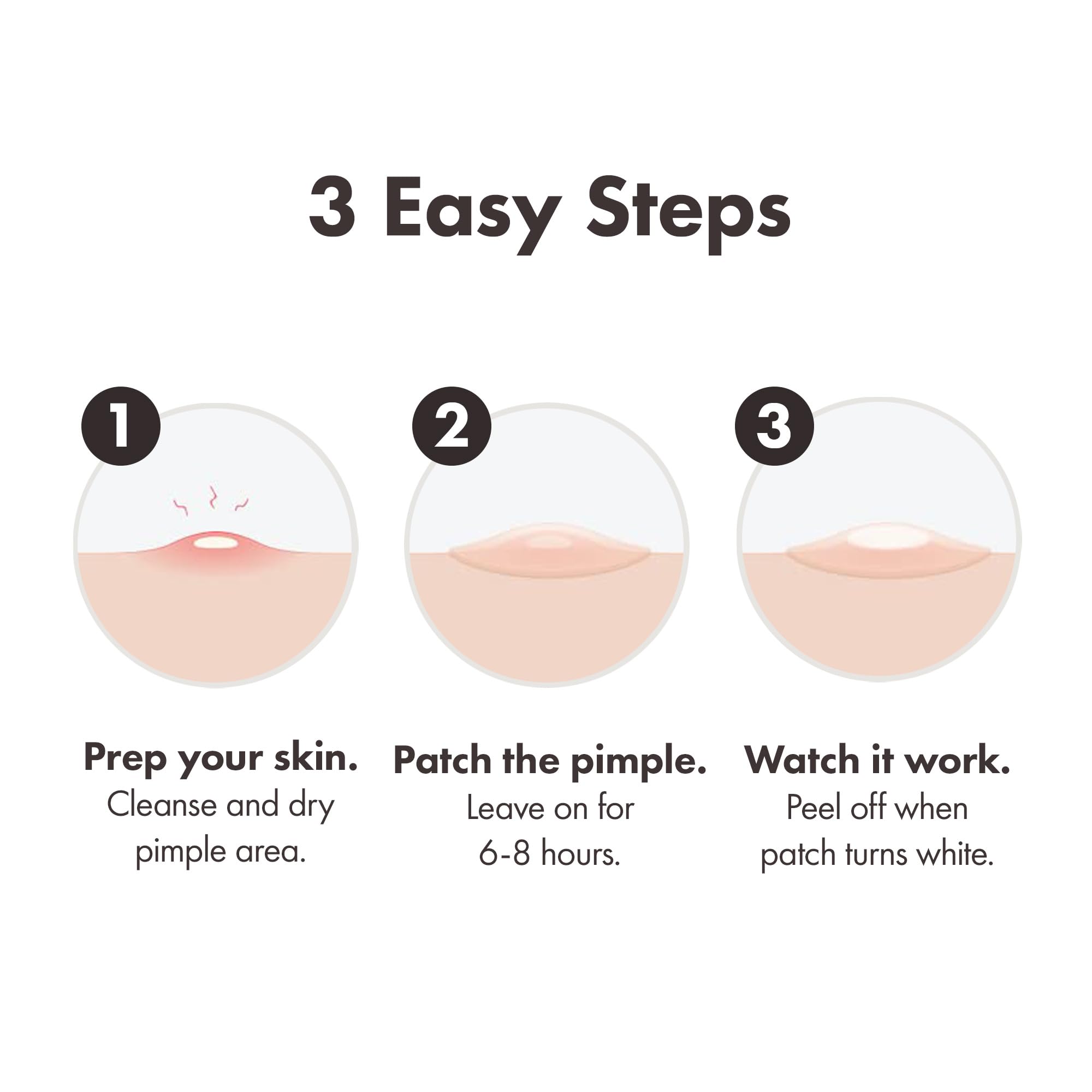 Hero Cosmetics - Mighty Patch Invisible+ Hydrocolloid Acne Patches (78 Count)