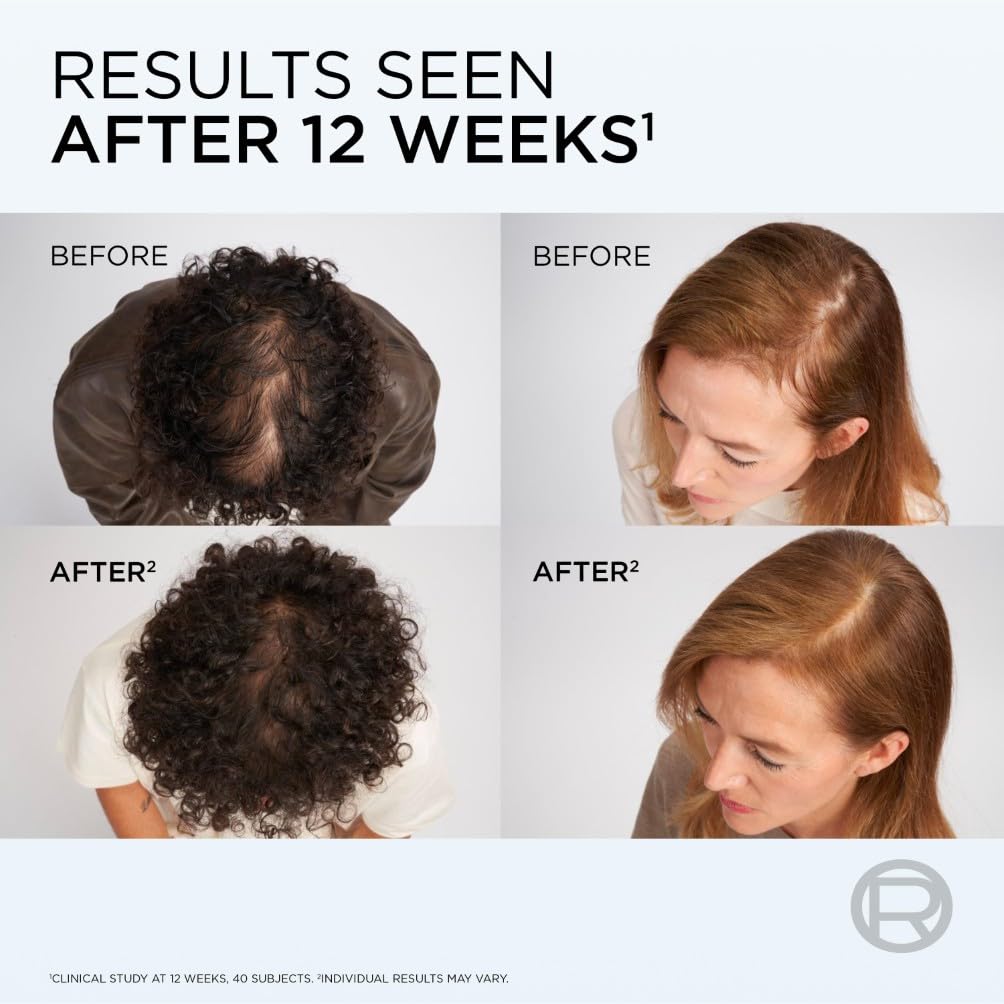 L'Oréal Paris - Elvive Growth Booster Conditioner (150ml) 3