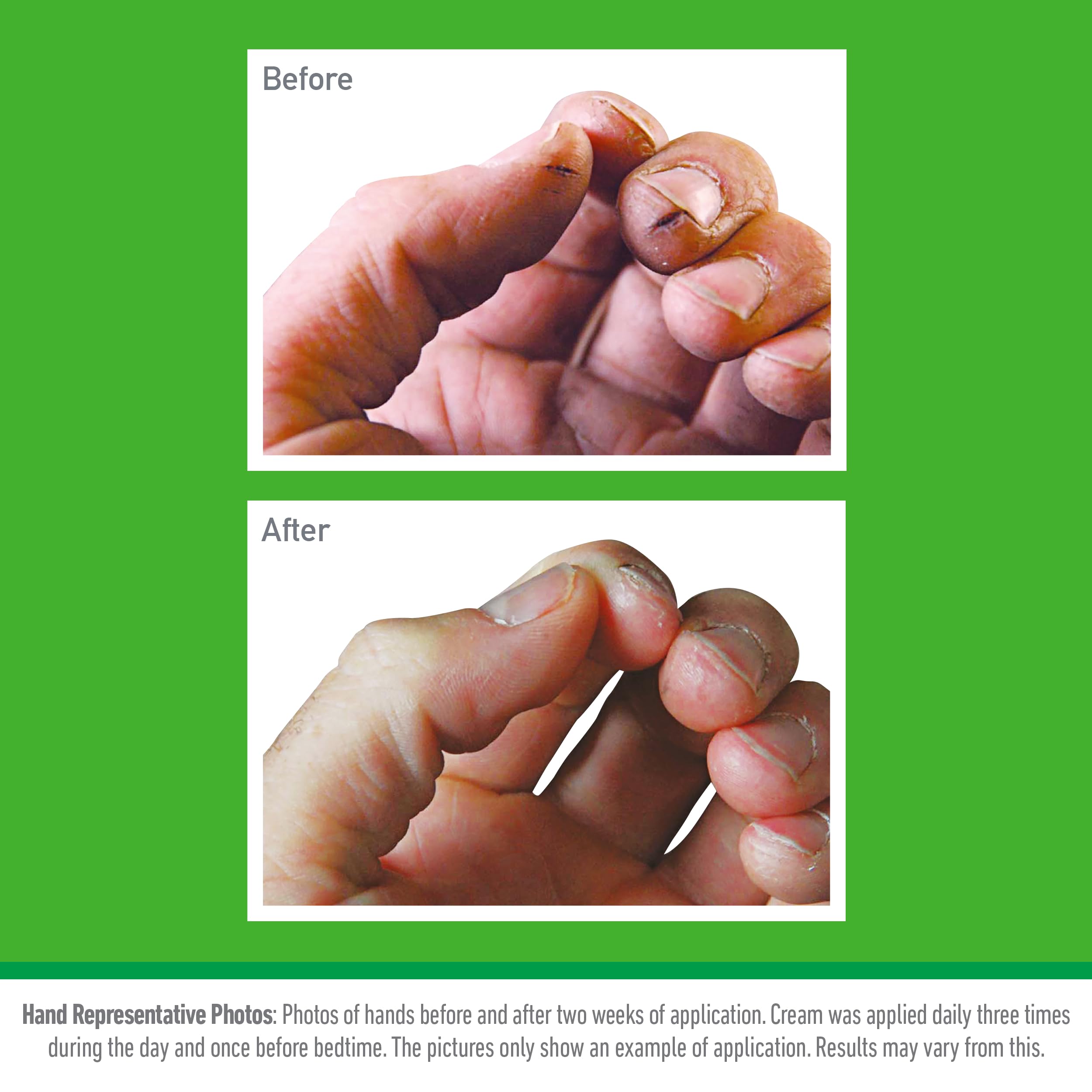 O'Keeffe's Working Hands Moisturizing Hand Cream (96g Jar, Pack of 6) 12