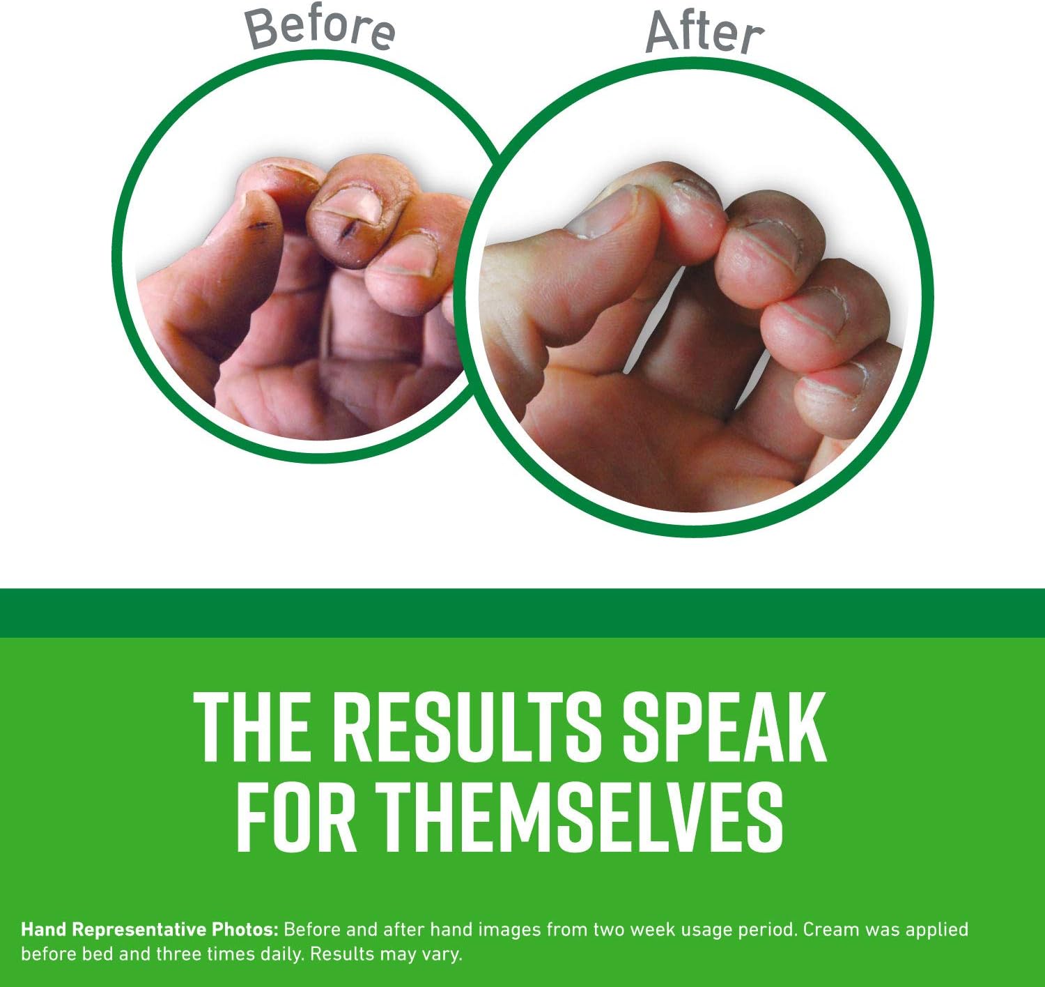 O'Keeffe's Working Hands Hand Cream (140.61g) 5