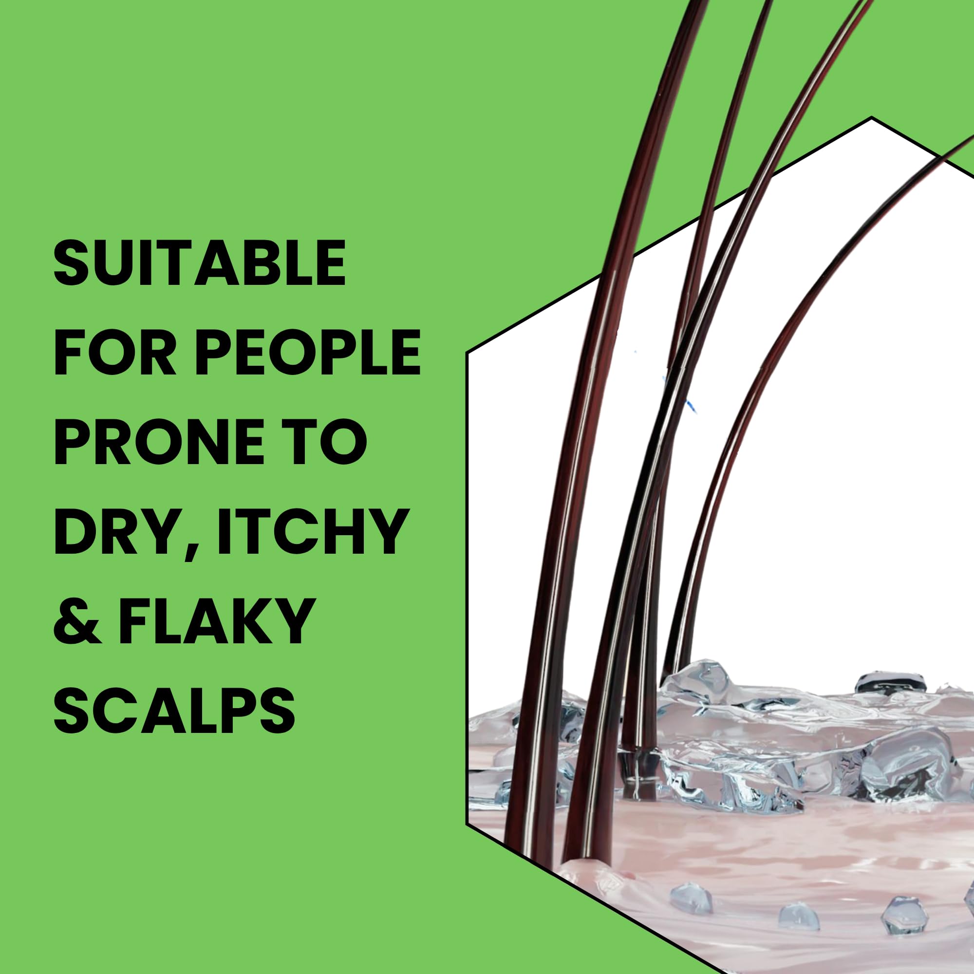 Nizoral - Scalp Soothing Itchy & Sensitive Shampoo (200ml) 4