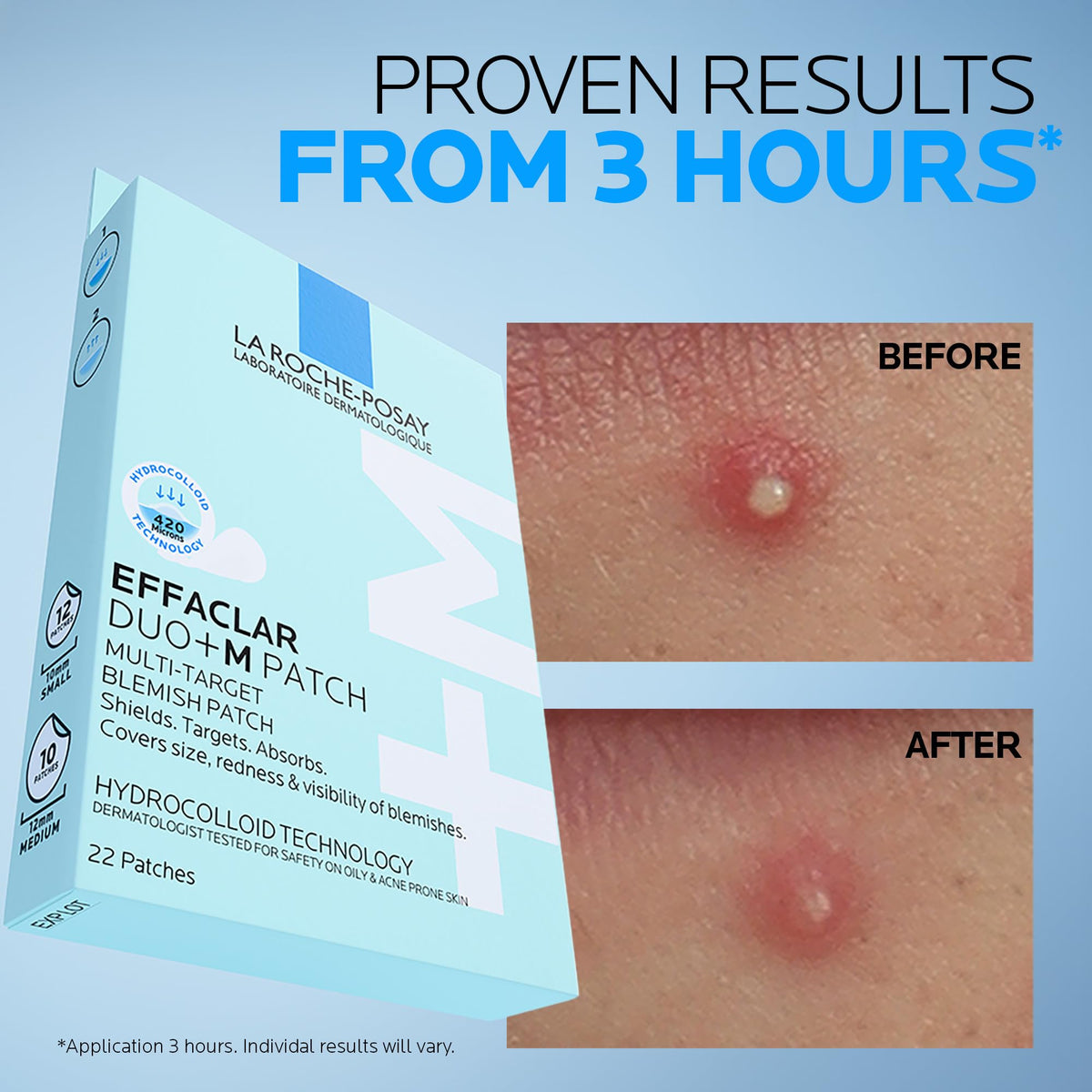 La Roche-Posay Effaclar Duo+M Spot Patches - 22 Hydrocolloid Patches, Two Sizes
