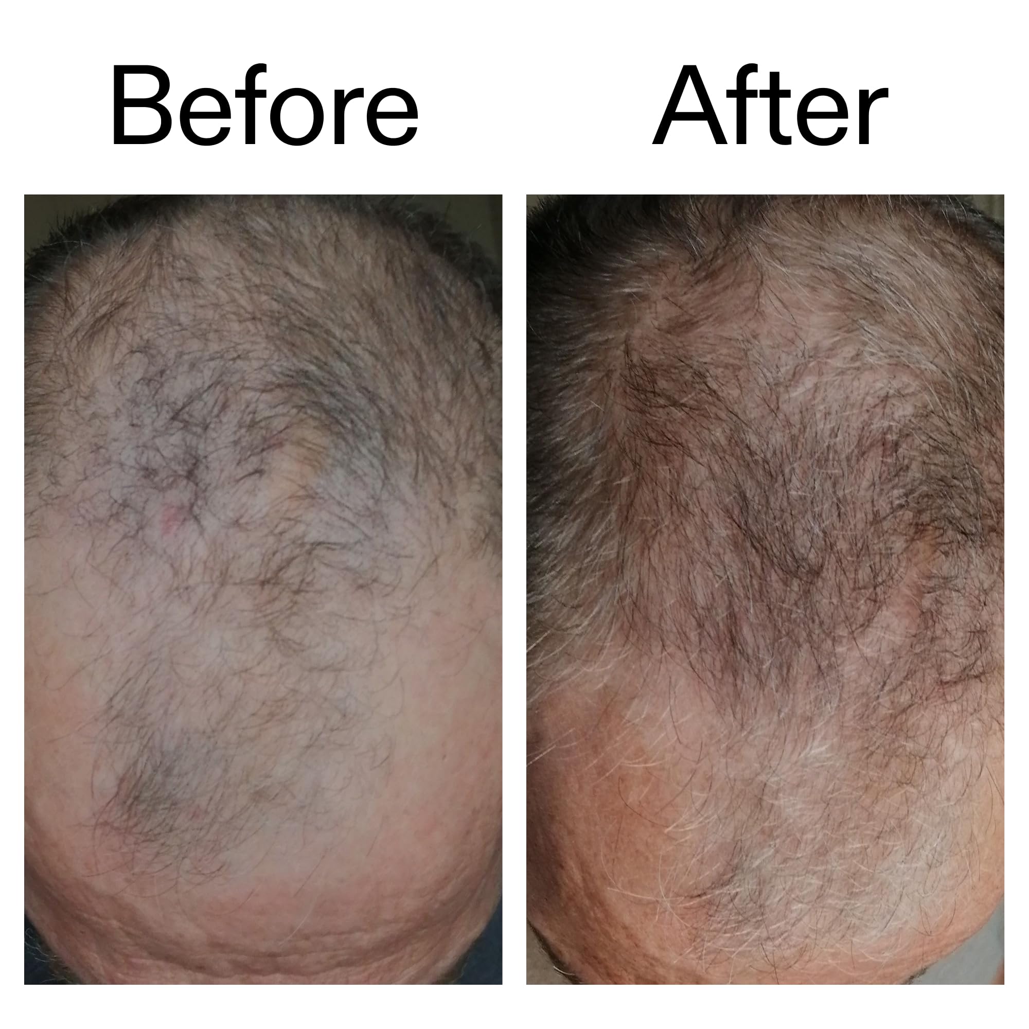 The INKEY List 1% Caffeine Stimulating Scalp Serum - Reduces Hair Loss, Improves Thickness | 150ml 5