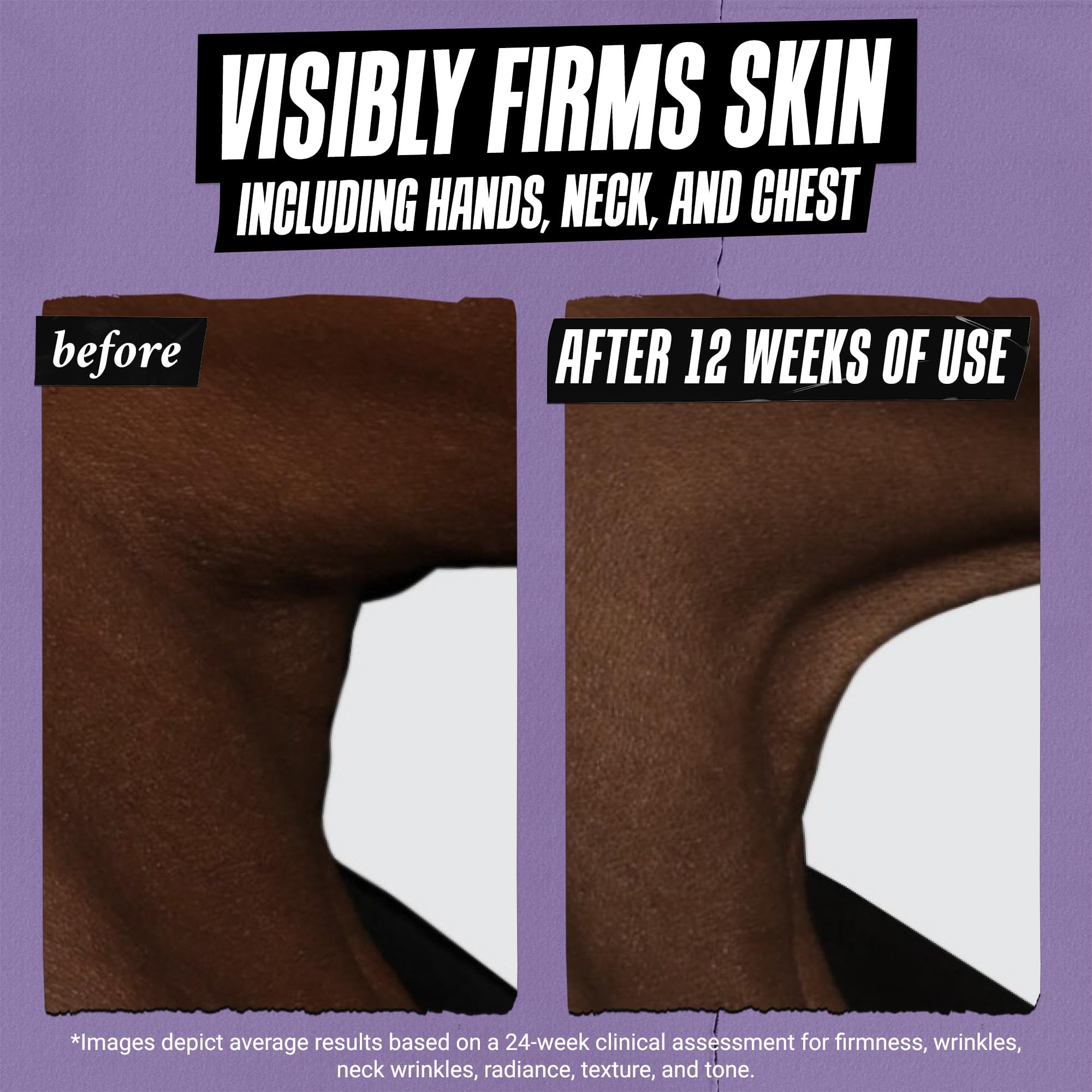 Kiehl's Retinol Skin-Renewing Daily Micro-Dose Serum - Reduces Wrinkles, Firms Skin | 50 ml 8